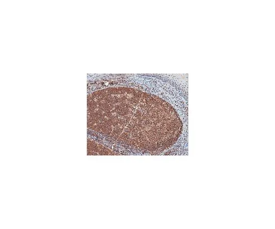62-8465-95　抗CLEC16A　ABN167