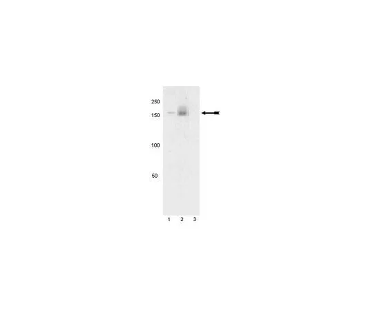 62-8386-85　抗磷PDGFRα (Tyr742);100μL　07-861