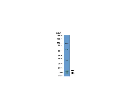 62-8374-29　抗VEGF,克隆CH-10;100μg　05-1116