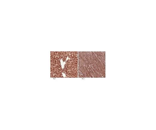 62-8459-68　抗THAP11 (罗宁);100μg　ABD75
