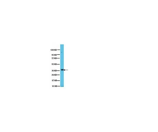 62-8387-20　抗PP1γ1;100μg　07-1218