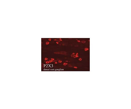 62-8451-87　抗P2X3受体，疼痛;50μL　AB5896
