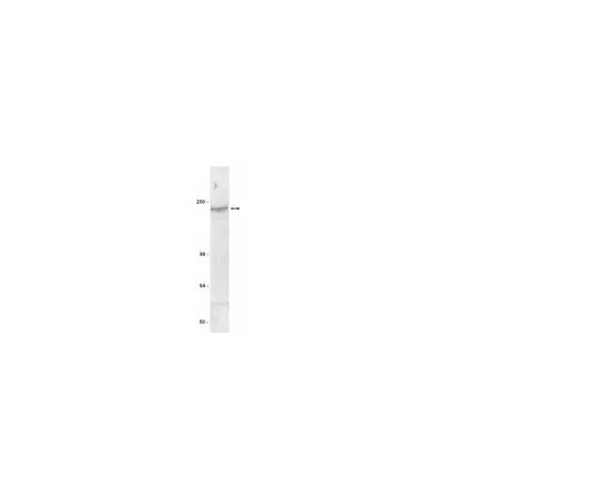 62-8371-81　抗CFTR,克隆MM13-4;200μg　05-581