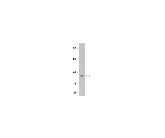 62-8385-52　抗Spry2;200μg　07-524