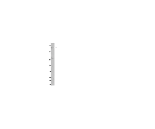 62-8368-81　抗ROKα/ROCK-II,克隆A9W4;200μL　04-841