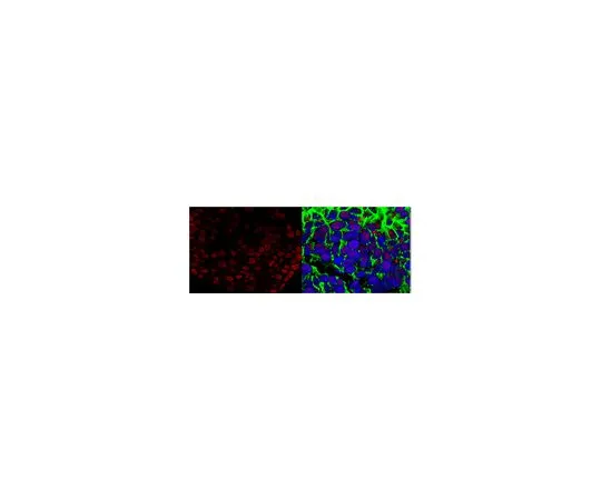 62-8450-72　抗索2;100μg　AB5603