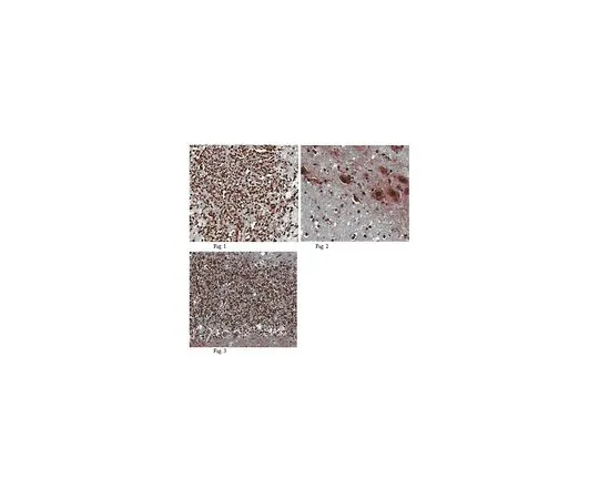 62-8456-67　反Hunk;100μg　ABC91