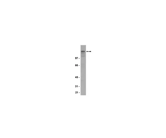 62-8373-72　抗NR2B,克隆BWJHL;100μg　05-920