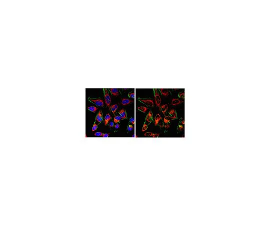 62-8382-62　抗预期麦角甾醇生物合成蛋白28;200μL　06-1028