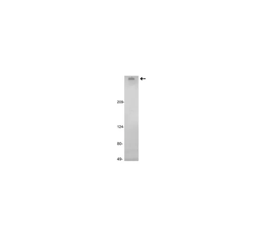 62-8373-49　抗因子VIII,克隆GMA-012;100μg　05-871