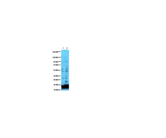 62-8448-62　抗乙酰赖氨酸;100μg　AB3879