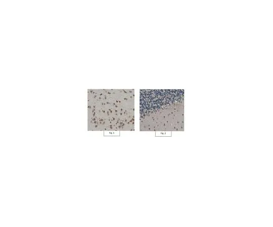 62-8455-90　抗肿瘤药2;100μg　AB15894