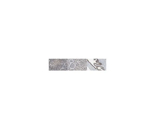 62-8381-94　反FADD;200μg　06-711