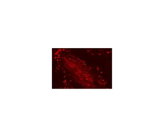 62-8394-38　慢Brite (TM) 帕西林-RFP慢病毒生物传感器　17-10155