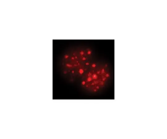 62-8385-10　抗三甲基组蛋白H3 (Lys9);100μg　07-442