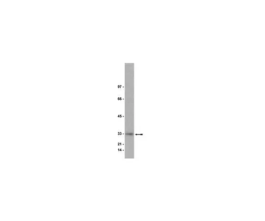 62-8381-38　Anti-Kip1 (p27);200μg　06-445