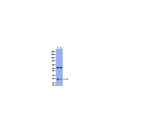62-8447-05　抗磷比德 (Ser65);100μg　AB2994
