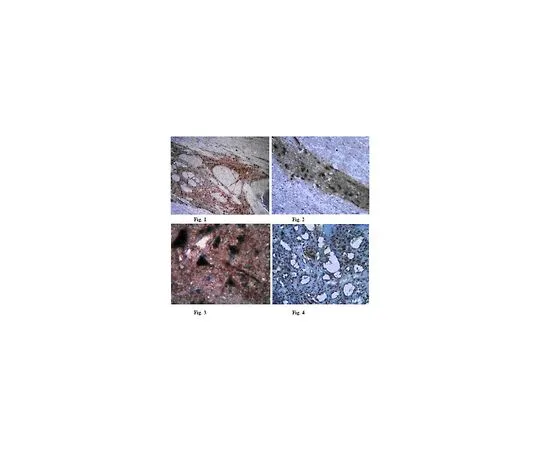 62-8454-62　反TIGAR;100μg　AB10545