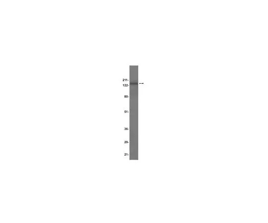 62-8384-03　抗AKAP 150;200μL　07-210