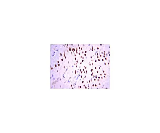 62-8446-60　抗Tbr1;100μg　AB2261