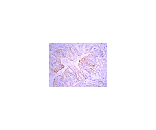 62-8374-84　抗磷酸脂酶A2,克隆CH-7;100μg　05-1406