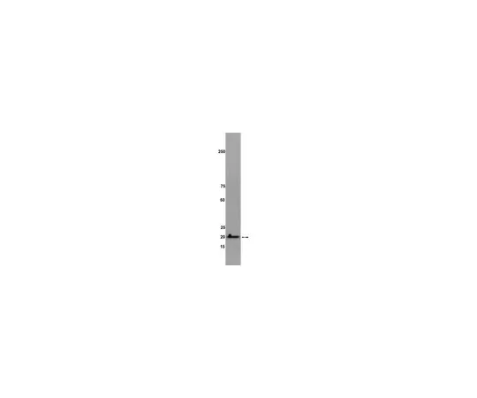 62-8368-34　抗RhoG,克隆1F3B3E5;100μg　04-486