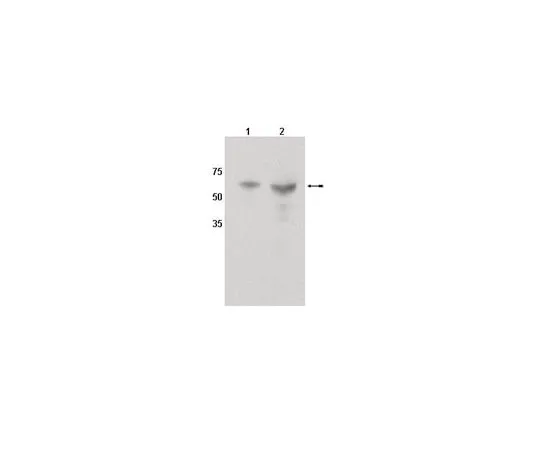 62-8454-09　抗CYP4501A1;100μg　AB10088