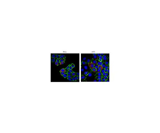 62-8447-04　反p32;100μg　AB2991