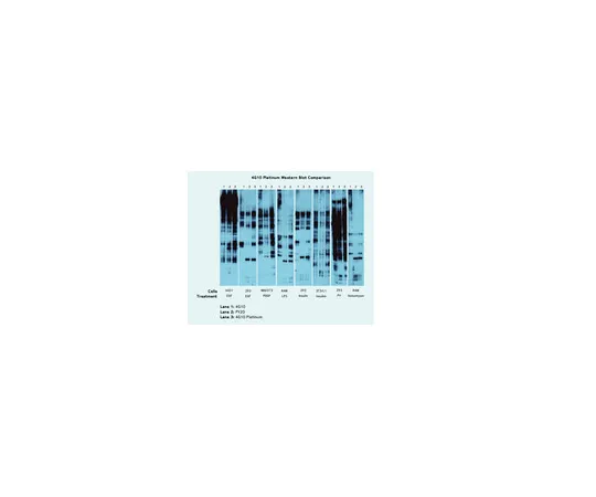 62-8374-05　抗磷酸酪氨酸，4G10 (R) 铂;30μL　05-1050X