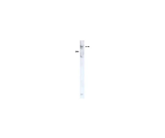 62-8371-50　反ATM,克隆AM9;200μL　05-513