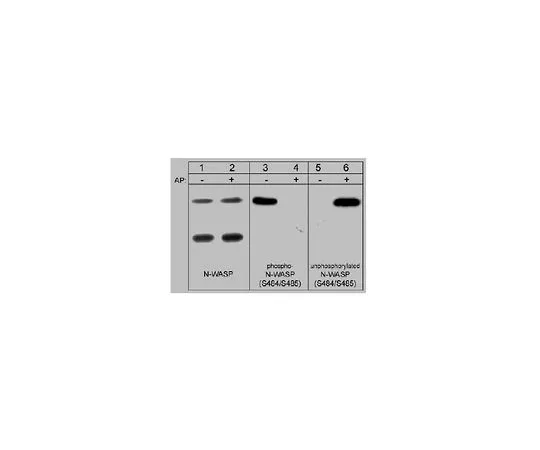 62-8446-15　抗N-WASP,磷特异性 [Ser484/Ser485];100μL　AB1964