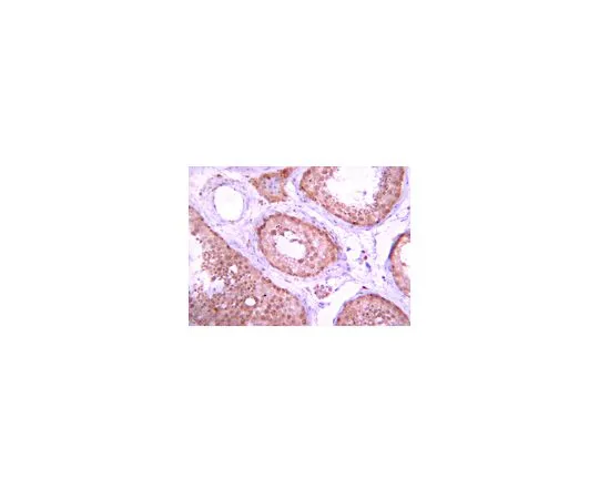 62-8387-25　抗蛋白磷酸酶5 (PP5);100μg　07-1225