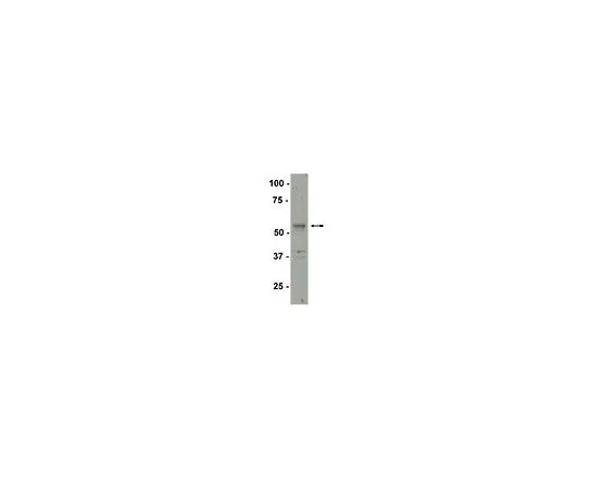 62-8385-94　反SF-1;200μg　07-618