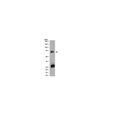 62-8455-91　抗维生素K依赖性蛋白S;100μg　AB15928