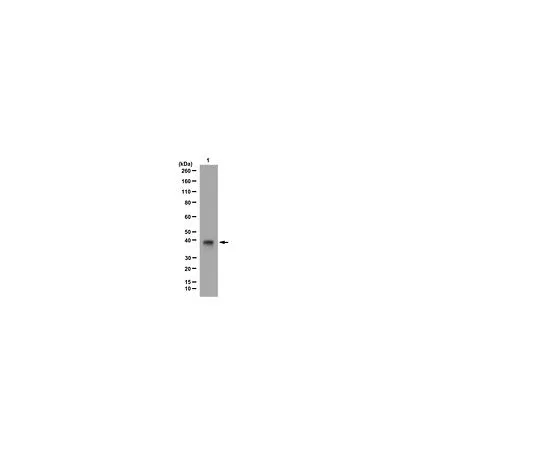 62-8390-05　反HDAC11;100μg　09-827