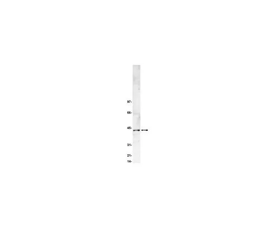 62-8382-23　抗酪蛋白激酶2;200μg　06-873