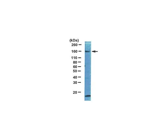 62-8381-22　抗IRS1;100μg　06-248