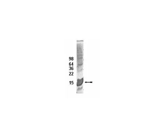 62-8391-67　UbcH5c共轭酶;100μg　14-811