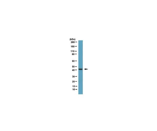 62-8388-38　抗Septin 2;100μL　07-1813