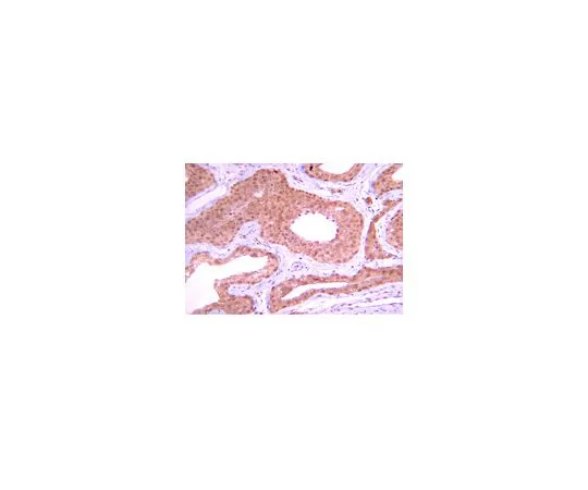 62-8387-19 抗PP1ββββββββββββββββββββββββββββββββββββββββββββββββββββββββββββββββββββββββββββββββββββββββββββββββββββ;100μg 07-1217