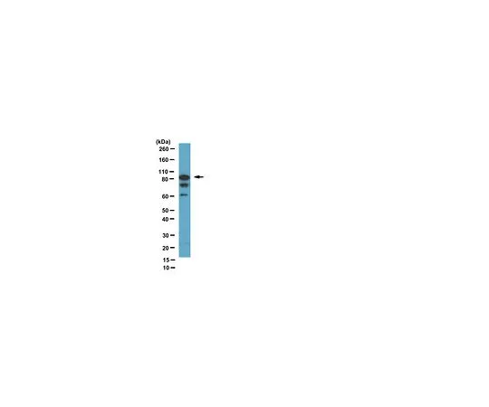 62-8383-08　抗旋风蛋白T1;100μL　06-1289