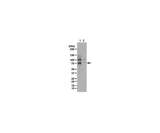 62-8387-93　抗磷WAVE2 (Ser343);100μL　07-1512