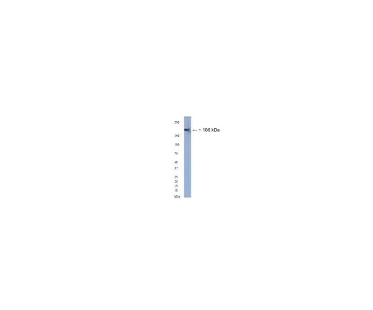 62-8454-93　抗神经法辛，普通表位;100μg　AB15188