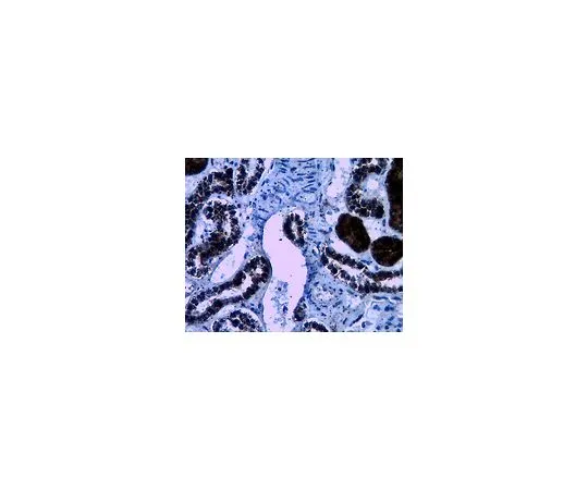 62-8388-93　反WNK4;100μg　7-70
