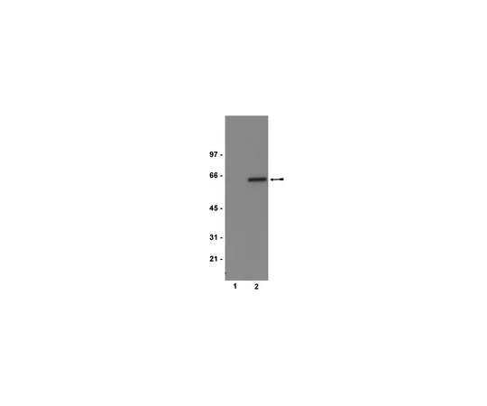 62-8372-37　抗磷酸化Akt1/PKBα (Ser473) ，克隆11E6;100μg　05-669