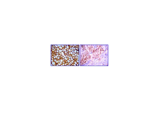 62-8374-31　抗c-erbB-4,克隆HFR1/2G4;100μg　05-1133
