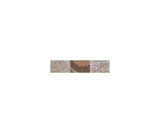 62-8455-04　反丹德林　AB15299-I