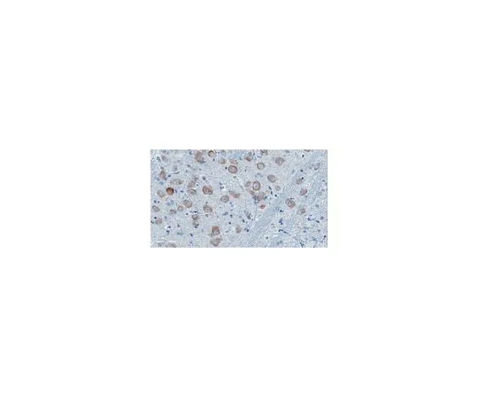 62-8468-12　抗ApoE4片段nApoECF抗体 (Asp172)　ABN1350