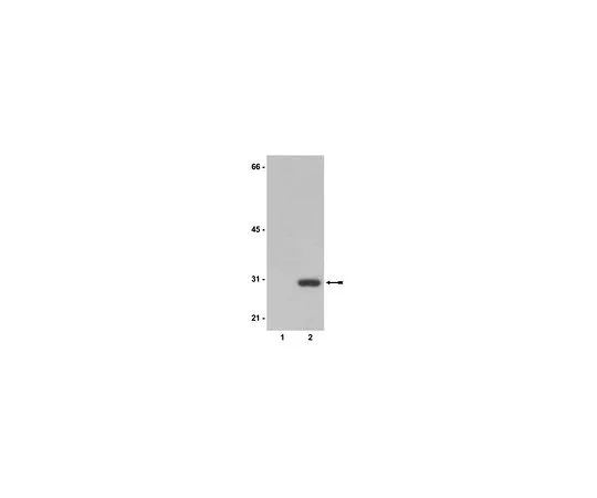 62-8382-04　抗新霉素磷酸化转移酶II;200μg　06-747