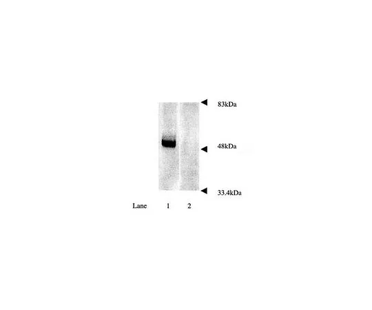 62-8449-16　反帕金，也是。305-323;50μL　AB5112